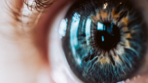 GLAUCOMA
