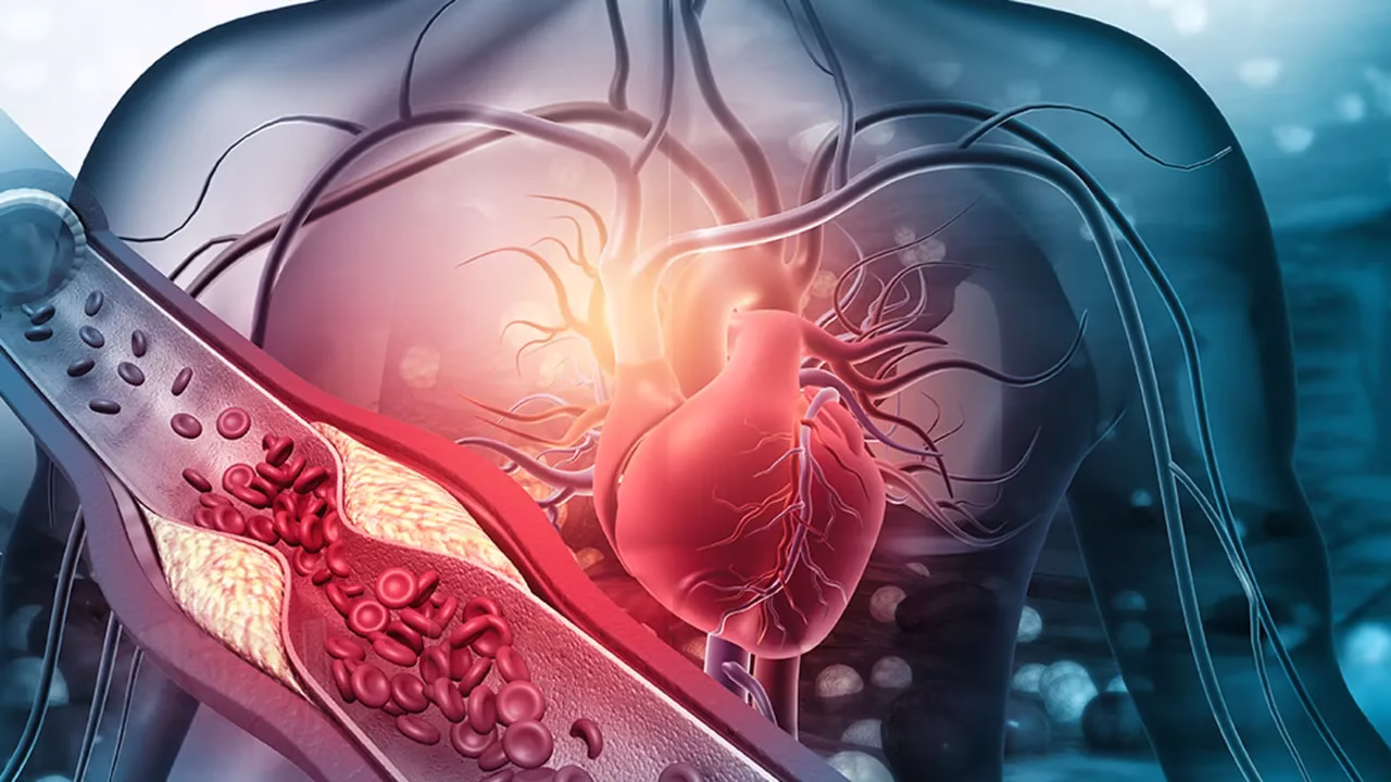 Enfermedades del corazón: la nueva crisis de salud en México 5 Enfermedades del corazón: la nueva crisis de salud en México