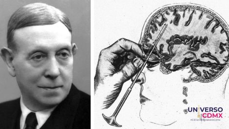 WebCDM El tragico avance medico que gano un Premio Nobel la lobotomia