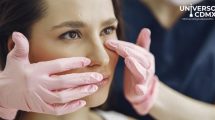 Parálisis Facial: Cuando la Sonrisa se Desvanece