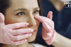 Parálisis Facial: Cuando la Sonrisa se Desvanece