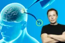 neuralink elon musk 3139386